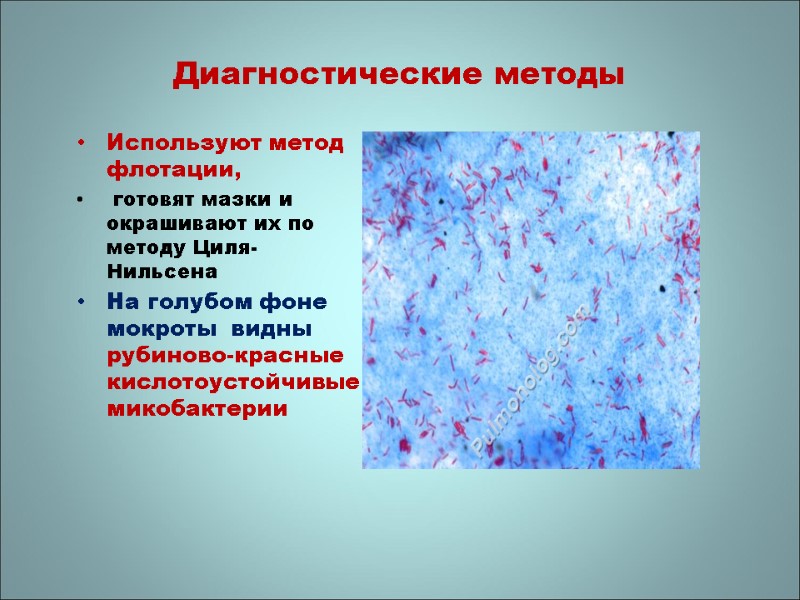 Диагностические методы Используют метод флотации,  готовят мазки и окрашивают их по методу Циля-Нильсена